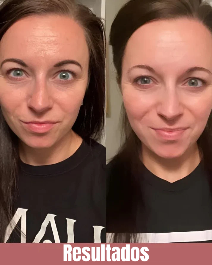 Máscara Bio-Colágeno